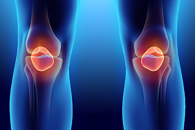 Torn Meniscus Stem Cell Treatment in Midland Park, NJ