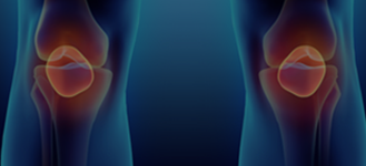 Meniscus Tear Doctor Midland Park NJ